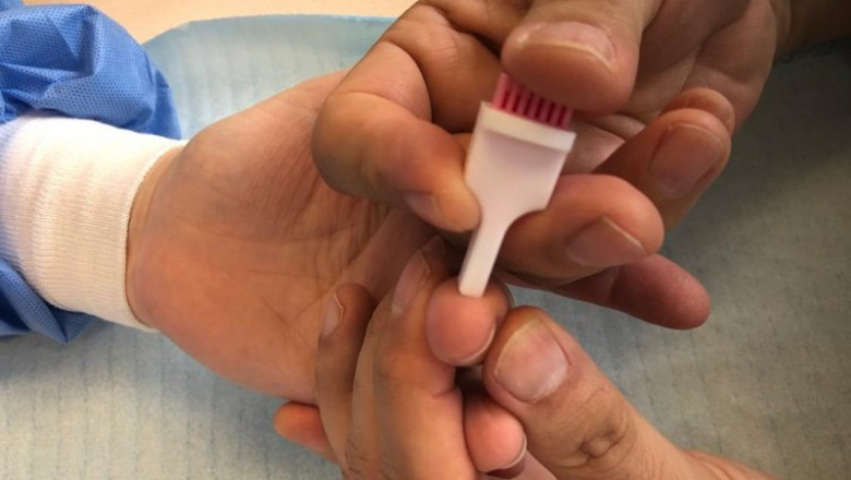 Un test serológico | GOBIERNO ep un test serologico