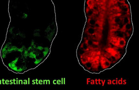ep esta imagen muestra celulas madre intestinales verdes y acidos grasos rojos en el intestino de