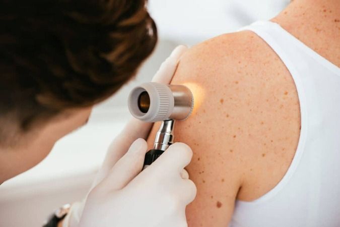 1 ndp   dermatologia cancer piel