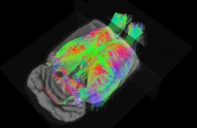ep estudiola resonancia magneticaalzheimer