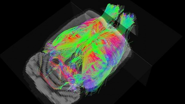 ep estudiola resonancia magneticaalzheimer
