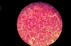 ep gonorrea neisseria gonorrhoeae en probeta