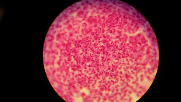 ep gonorrea neisseria gonorrhoeae en probeta