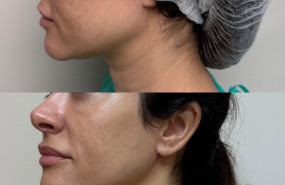 2dfdf3c4 692a 4703 8c68 ba9cd6cf82d4 1 20250130145020 2dfdf3c4 692a 4703 8c68 ba9cd6cf82d4 1 20250130145020