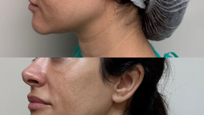 2dfdf3c4 692a 4703 8c68 ba9cd6cf82d4 1 20250130145020 