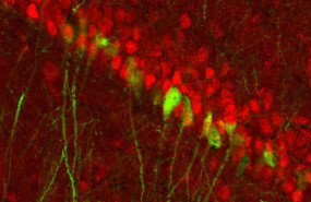 ep encuentran un circuito cerebral diferenciado por genero para la depresion que se activa durante