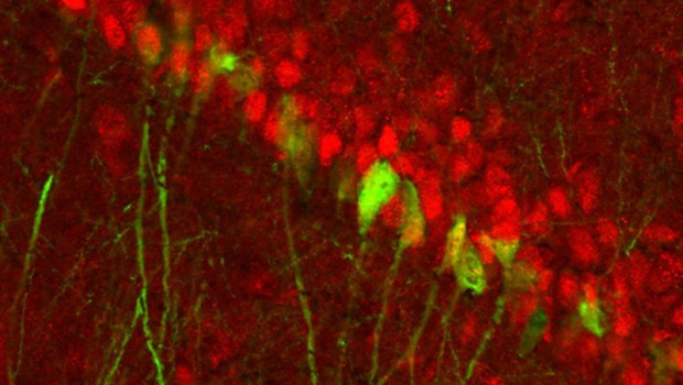 ep encuentran un circuito cerebral diferenciado por genero para la depresion que se activa durante