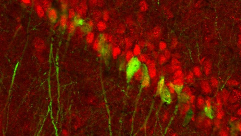 ep encuentran un circuito cerebral diferenciado por genero para la depresion que se activa durante