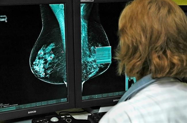 Oncólogos estudian nuevos medicamentos contra el cáncer de mama | JCCM/EUROPA PRESS ep oncologos estudian nuevos medicamentoscancermama