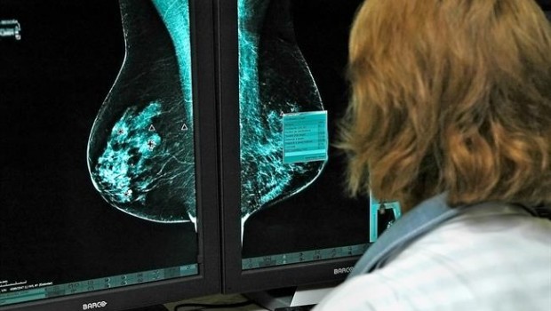 ep oncologos estudian nuevos medicamentoscancermama