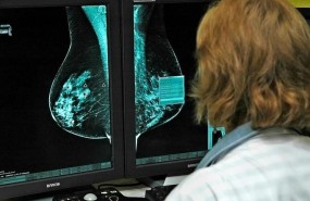 ep investigacioncancermama
