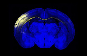 ep seccion horizontal del cerebro del raton un grupo de neuronas de la corteza iluminadas en