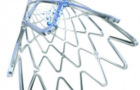 ep stent