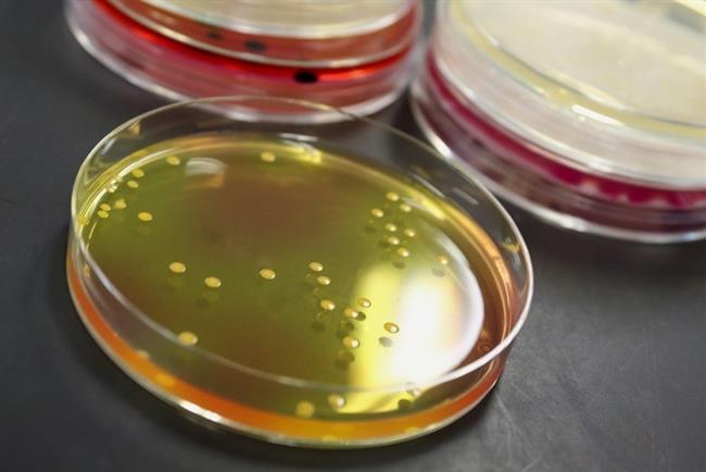 ep clostridium botulinum botulismo