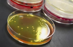 ep clostridium botulinum botulismo