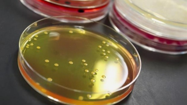 ep clostridium botulinum botulismo