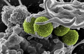 ep staphylococcus aureus interactuauna celula inmune estafilococo