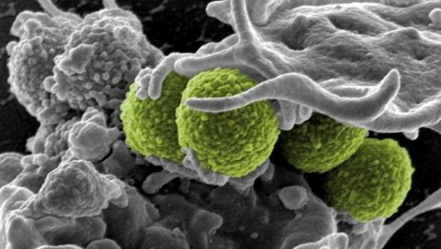 ep staphylococcus aureus interactuauna celula inmune estafilococo