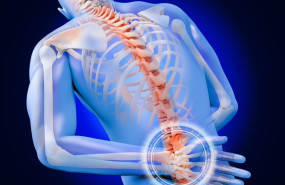 2 ndp coccigodinia 1