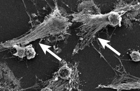 ep parte del sistema inmunologico del cuerpo los neutrofilos detectan las bacterias y pueden