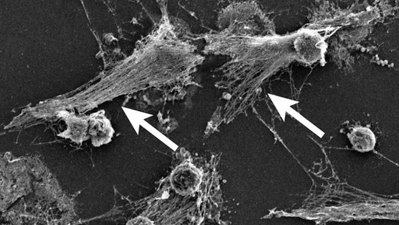 ep parte del sistema inmunologico del cuerpo los neutrofilos detectan las bacterias y pueden
