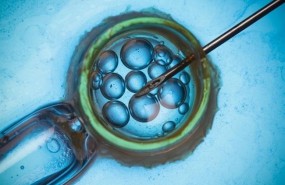 ep fecundacion in vitro tratamiento fertilidad
