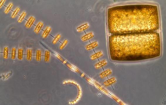 Células de diatomeas observadas al microscopio | ISABEL G. TEIXEIRA ep celulasdiatomeas observadasmicroscopio