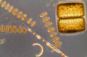 ep celulasdiatomeas observadasmicroscopio