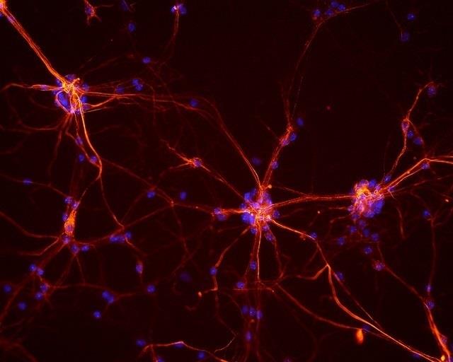 Neuronas | NICHD/FLICKR ep neuronas 20170510173408