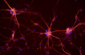 ep neuronas 20170510173408