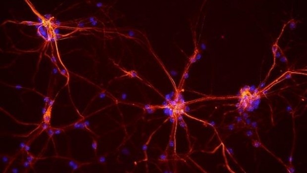 ep neuronas 20170510173408