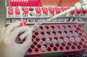 ep a medical technical assistant prepares samples from patients for virus diagnostics pcr on a ep a medical technical assistant prepares samples from patients for virus diagnostics pcr on a