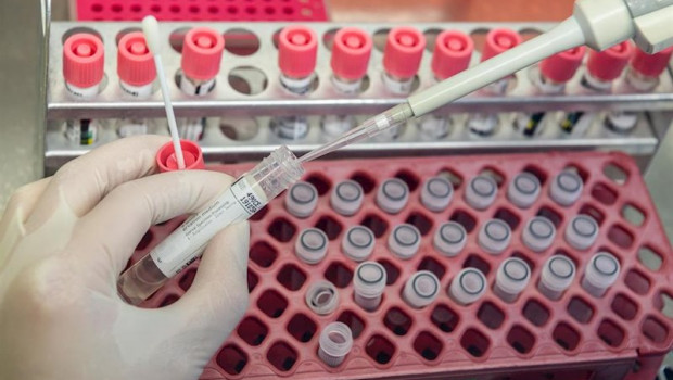 ep a medical technical assistant prepares samples from patients for virus diagnostics pcr on a