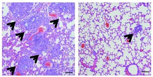 Cáncer de mama | WU ET AL., 2017 ep cancermama 20170308173202