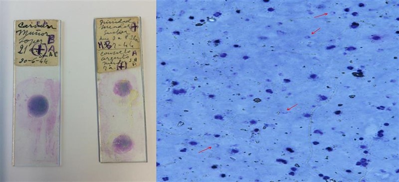 Dos muestras de los parásitos causantes de la malaria | CSIC - Archivo ep dos muestras de los parasitos causantes de la malaria