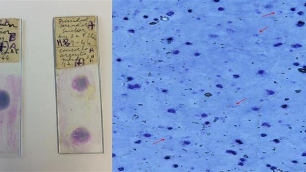 ep dos muestras de los parasitos causantes de la malaria
