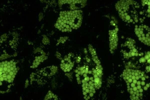 Las células grasas marrones sanas (que se muestran en verde) requieren grandes cantidades de una molécula llamada hemo, que permite al cuerpo metabolizar los alimentos adecuadamente. | INVESTIGACIÓN SCRIPPS ep las celulas grasas marrones sanas que se muestran en verde requieren grandes cantidades de una
