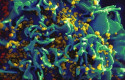 ep onusida dabienvenidalas nuevas evidenciasqueterapia antirretroviral detienetransmisionvih ep onusida dabienvenidalas nuevas evidenciasqueterapia antirretroviral detienetransmisionvih