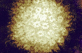 ep herpes zoster 20190802134305