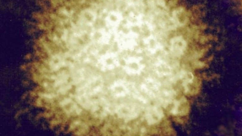 ep herpes zoster 20190802134305