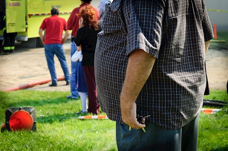 ep hombre con obesidad sobrepeso barriga