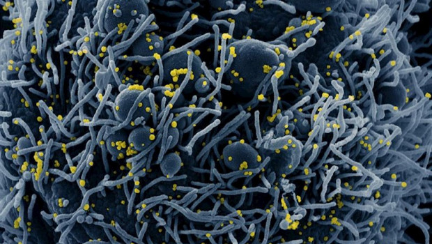 ep micrografia electronica de barrido coloreada de una celula apoptotica en azul infectada con