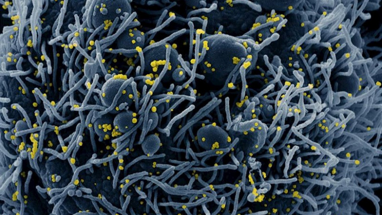 ep micrografia electronica de barrido coloreada de una celula apoptotica en azul infectada con ep micrografia electronica de barrido coloreada de una celula apoptotica en azul infectada con