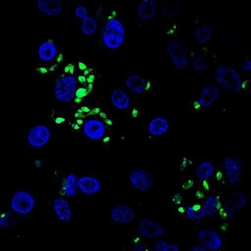 ep leishmania