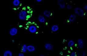 ep leishmania