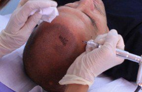 1595942900 cuidados edm