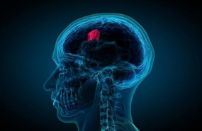 ep glioblastoma 20200504181705