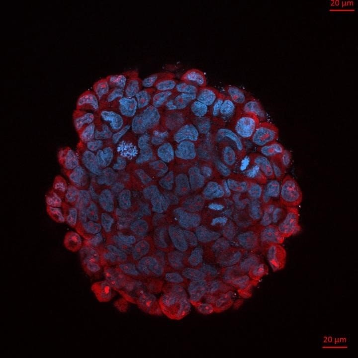 Un inhibidor de microARN identificado por investigadores del Centro de Investigación de Genoma Humano y Células Madre, apoyado por FAPESP, redujo el tamaño de los tumores agresivos y mejoró la supervivencia en ratones. | LABORATORIO DE GENÓMICA TRASLACIONAL, IB-USP ep un inhibidor de microarn identificado por investigadores del centro de investigacion de genoma