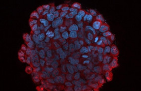ep un inhibidor de microarn identificado por investigadores del centro de investigacion de genoma