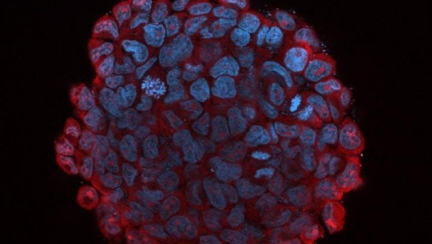 ep un inhibidor de microarn identificado por investigadores del centro de investigacion de genoma